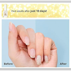 Eveline Cosmetics - 8-in-1 Nail Conditioner with Golden Particles
