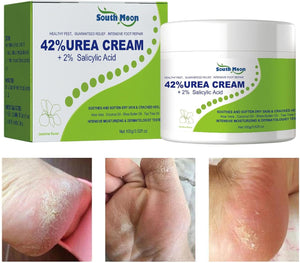 South Moon - 42% Urea Cream + 2% Salicylic Acid